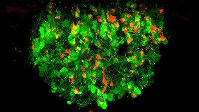 thirst neurons