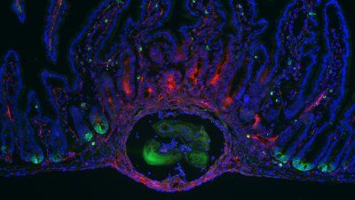 Ophir-Klein-study-gut-parasites.jpg