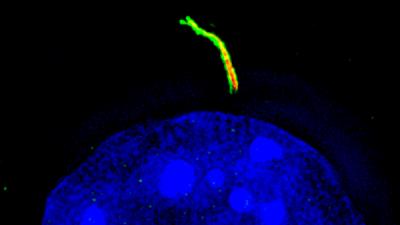cilia_fat_forming.jpg