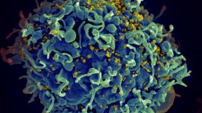 hiv_03_infected1_full.jpg