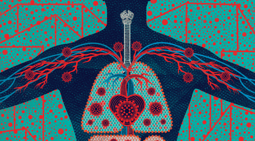 Illustration of the inside of a body, with coronavirus cells throughout.