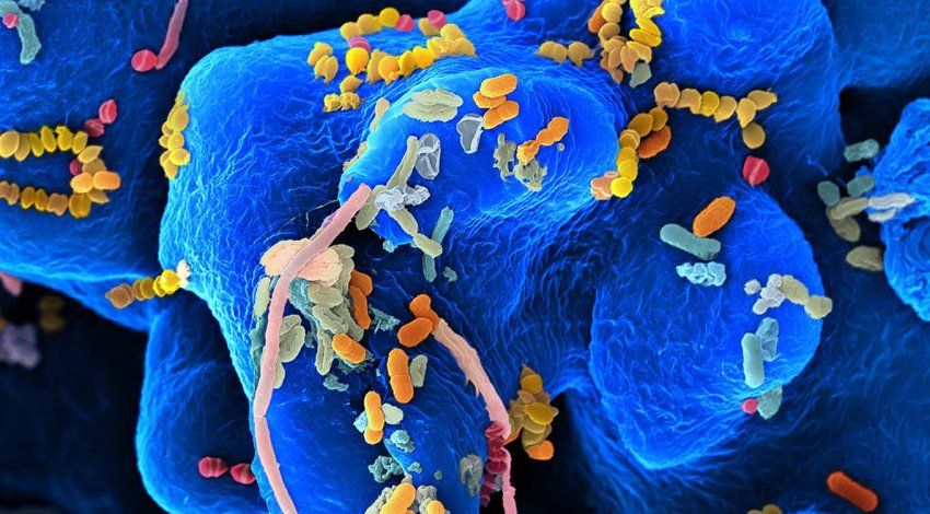Hand-colored image from a scanning electron microscope of oral bacteria.