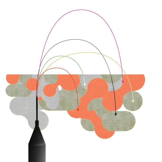 Illustration of a needle spraying fluid