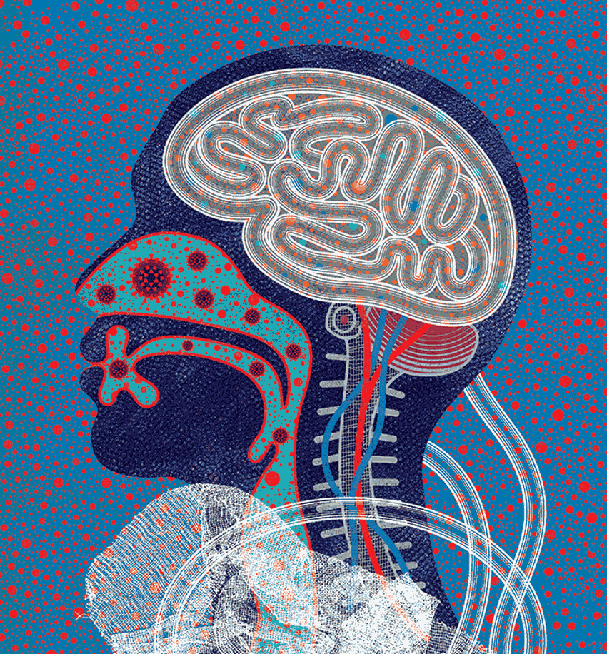 Distinguishing COVID-19 Brain Fog from Dementia, Delirium and