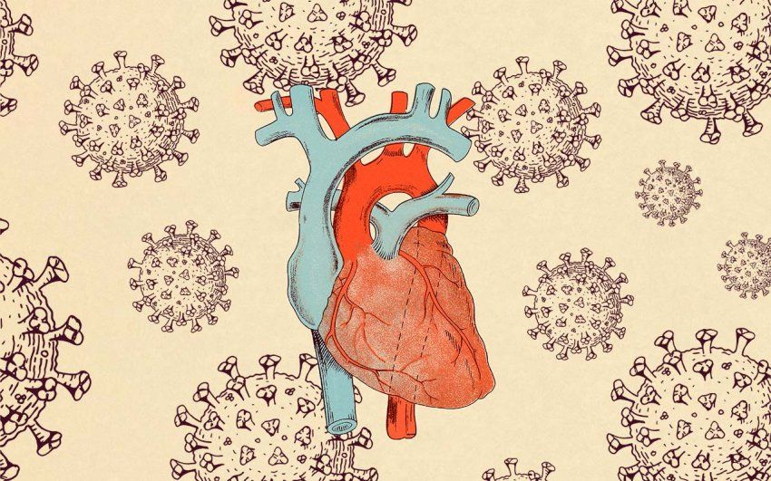 Vintage style illustration of a human heart with SARS-CoV-2 cells floating around it.