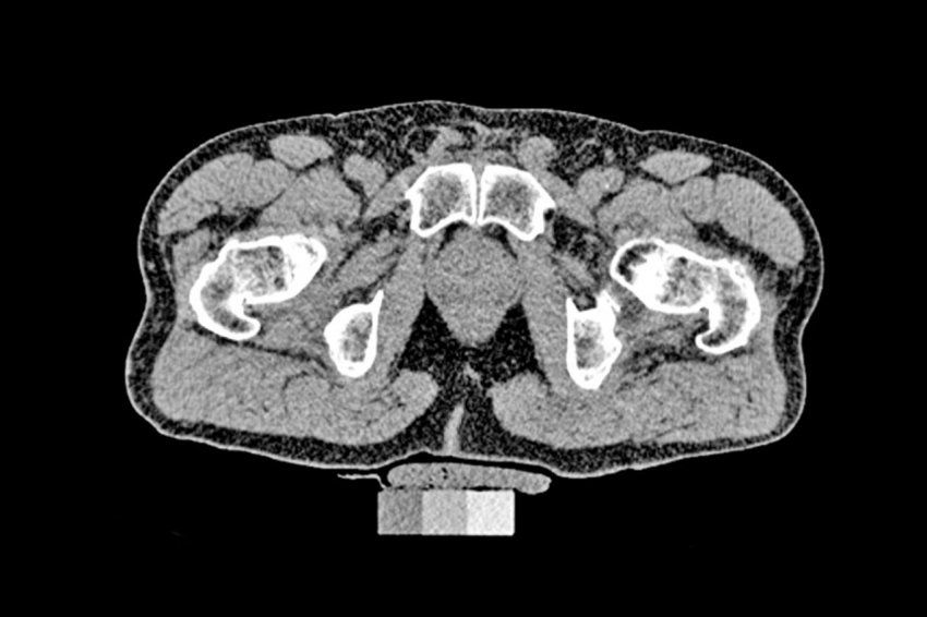 musculoskeletal imaging