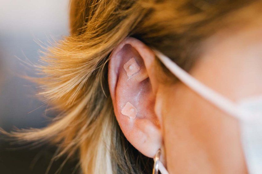 Acupressure seeds are small seeds attached to an adhesive strip that can be used to stimulate acupoints, especially on the ear, to support non-pharmacological symptom management.